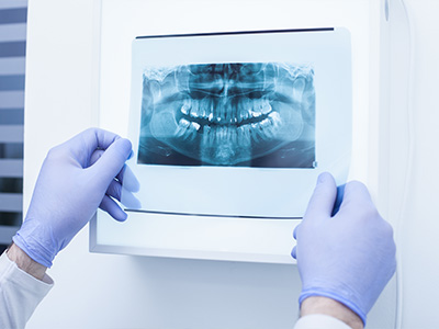 Sicklerville Dental Excellence | Oral Cancer Screening, Cone Beam Imaging  CBCT  and Growth   Development Monitoring